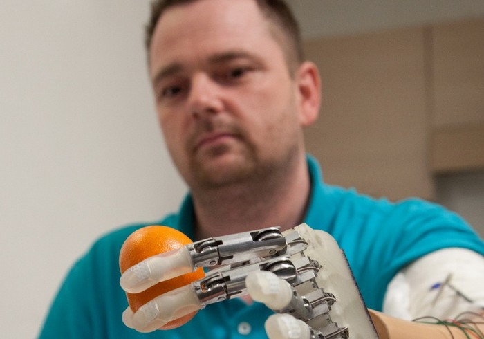 Bionic Hand - протез руки с тактильными ощущениями.