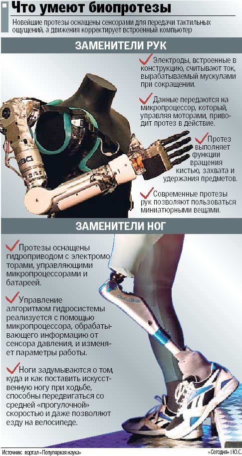 Бионические протезы презентация